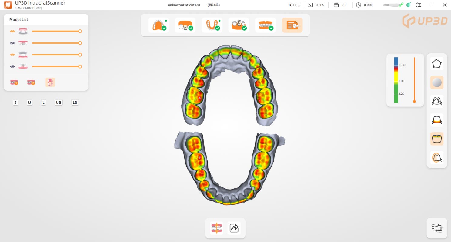 Occlusal Distance Map